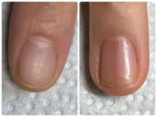 ネイル 耳ツボジュエリー💎 全身脱毛／肌質改善のエステ・リラクイメージ