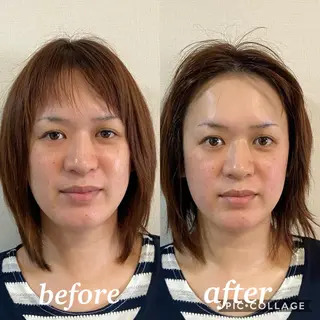 美容鍼WINBACK サロンRemeのエステ・リラクイメージ