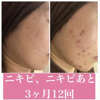 ミディアム カラー パーマ ヘアアレンジ メンズ キッズ ネイル マツエク・マツパ ニキビ・肌質改善専門 ♡人生が変わるサロンのエステ・リラクイメージ