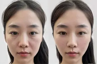 ネイル 愛維美水光専門店 川崎彩鳳のエステ・リラクイメージ