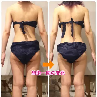 ロング カラー パーマ ヘアアレンジ メンズ キッズ ネイル マツエク・マツパ ‍痩身＆ボディ 結果出し🌟丹野のエステ・リラクイメージ