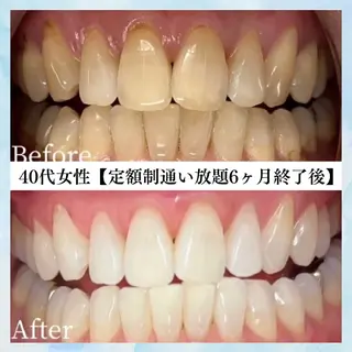 メンズ キッズ セルフホワイトニング WHITE福岡天神店のエステ・リラクイメージ