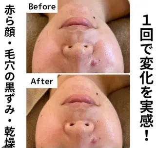 美BELLO 池袋のエステ・リラクイメージ