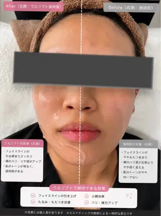 マツエク・マツパ 愛維美水光美肌専門店 メンズレディースokのエステ・リラクイメージ