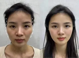 ネイル 愛維美水光専門店 川崎彩鳳のエステ・リラクイメージ