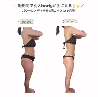 《本気痩せ×疲労改善 》  BILOOPのエステ・リラクイメージ