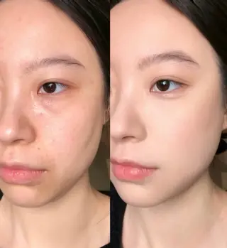 マツエク・マツパ 愛維美水光専門店 川崎彩鳳のエステ・リラクイメージ
