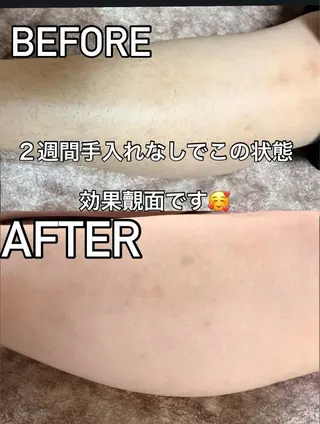 脱毛サロン moco selfのエステ・リラクイメージ