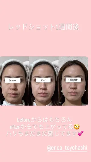 コルギ/全身リンパ saoriのエステ・リラクイメージ