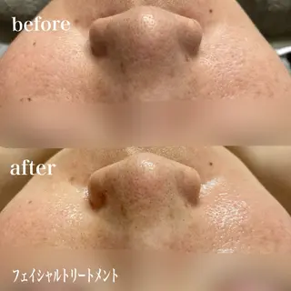 磐田|LAYLA 一番丁寧な脱毛店のエステ・リラクイメージ
