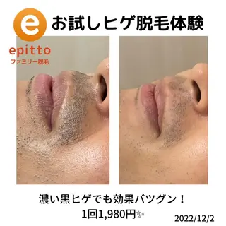 メンズ エピット横浜磯子店 大森のエステ・リラクイメージ