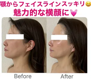 小顔サロン (ラ リュミエール)のエステ・リラクイメージ