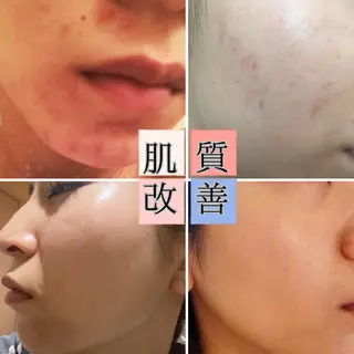 村田 結加のエステ・リラクイメージ