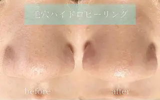 メンズ 稲嶺 美華のエステ・リラクイメージ