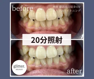 ホワイトニング専門店 glitterのその他イメージ