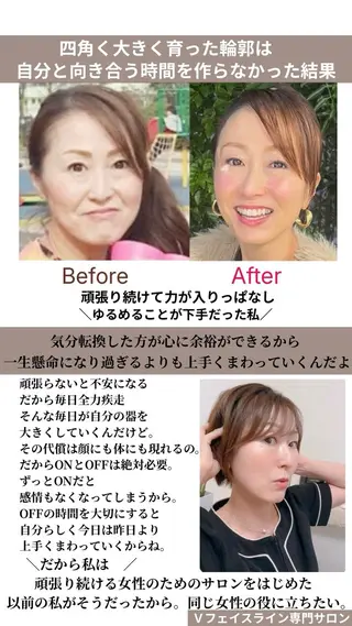小顔サロン (ラ リュミエール)のエステ・リラクイメージ