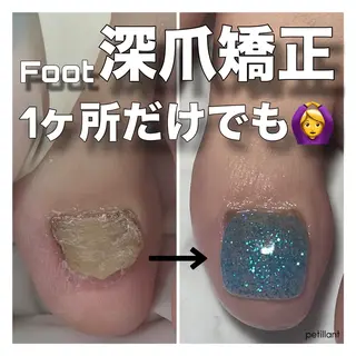 ネイル nail salon petillantのネイルデザイン