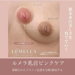 ニキビ/美肌 メゾンリュバンのエステ・リラクイメージ