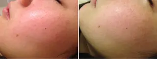 ミディアム カラー パーマ ヘアアレンジ メンズ キッズ ネイル マツエク・マツパ アニメ,Vオタク× 即効痩せエステサロンのエステ・リラクイメージ