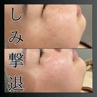 LiZA エステティックサロンのエステ・リラクイメージ
