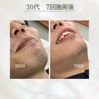 LED脱毛サロン 💐ayaのエステ・リラクイメージ