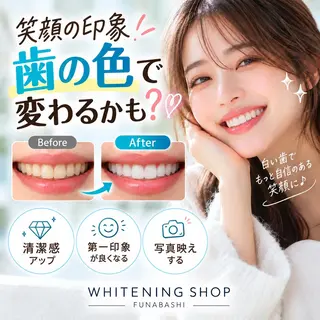 ホワイトニング ショップ船橋店のエステ・リラクイメージ
