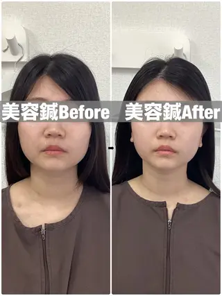 ハリサロンドオフ 美容鍼灸×小顔整体のエステ・リラクイメージ