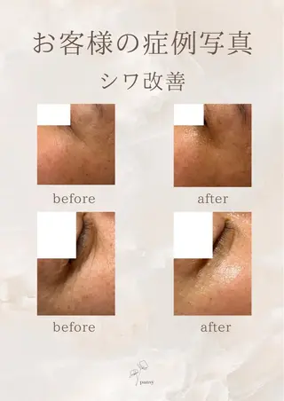 pansy フェイシャルエステのエステ・リラクイメージ
