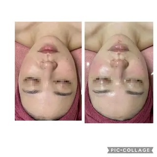 伊藤 順子のエステ・リラクイメージ