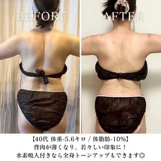 【西荻窪】本格痩身 最新型よもぎ蒸しのエステ・リラクイメージ
