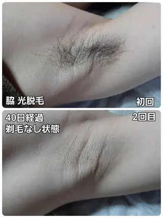 メンズ 山村幸久 メンズ脱毛 ディアーズのエステ・リラクイメージ
