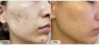 salon aretéのエステ・リラクイメージ