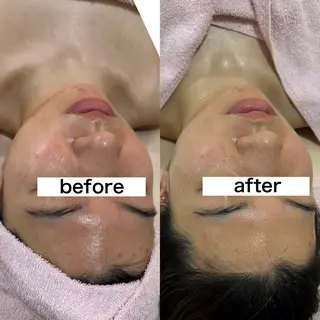 salondeBe 🩵フェイシャル専門のエステ・リラクイメージ