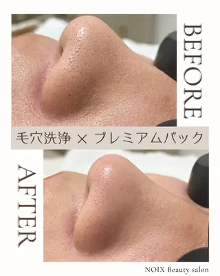 NOIXbeauty salonのエステ・リラクイメージ