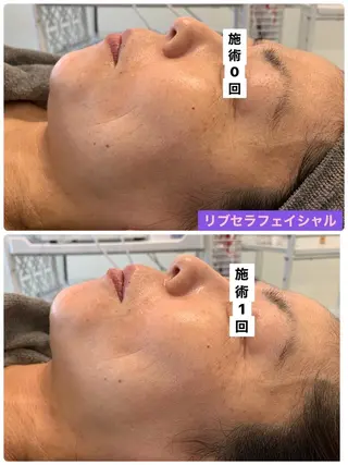プライベートサロン プリュネルのエステ・リラクイメージ