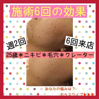 ミディアム カラー パーマ ヘアアレンジ メンズ キッズ ネイル マツエク・マツパ ニキビ・肌質改善専門 ♡人生が変わるサロンのエステ・リラクイメージ