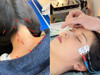 小顔美容鍼 渋谷 YZ 山崎のエステ・リラクイメージ