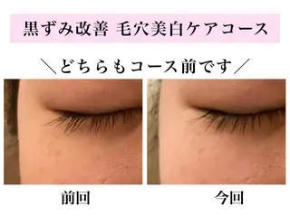 Bellesthe (ベルエステ)のエステ・リラクイメージ