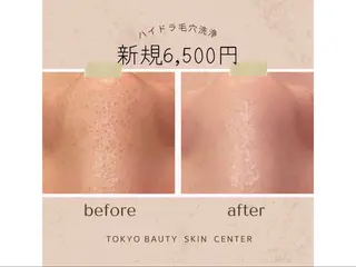 脱毛/毛穴洗浄/痩身 東京ビューティー新宿のエステ・リラクイメージ