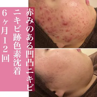 ミディアム カラー パーマ ヘアアレンジ メンズ キッズ ネイル マツエク・マツパ ニキビ・肌質改善専門 ♡人生が変わるサロンのエステ・リラクイメージ