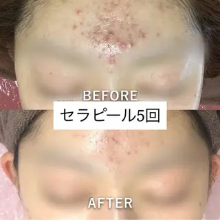 エステティックサロン Viveのエステ・リラクイメージ