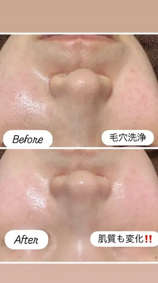 看護師 桐山 まどかのエステ・リラクイメージ