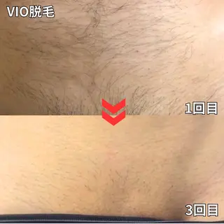 メンズ 都度払い制メンズ脱毛 オーナーのエステ・リラクイメージ