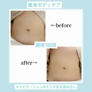💜Karen PrivateSpaのエステ・リラクイメージ