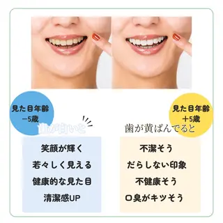 東区香椎歯のセルフホ ワイトニングGLOWのその他イメージ