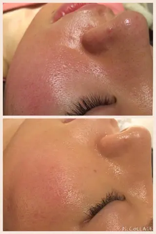 セミロング カラー パーマ ヘアアレンジ メンズ キッズ ネイル マツエク・マツパ アニメ,Vオタク× 即効痩せエステサロンのエステ・リラクイメージ
