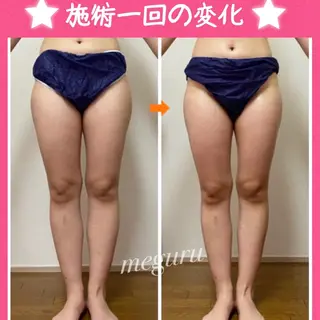 ショート カラー パーマ ヘアアレンジ メンズ ネイル マツエク・マツパ 痩身&ボディ 結果出し🌟丹野のエステ・リラクイメージ