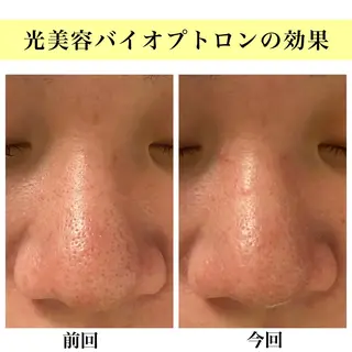 Bellesthe (ベルエステ)のエステ・リラクイメージ