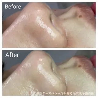 深い肌悩み&早期脱毛 完了サロンのエステ・リラクイメージ