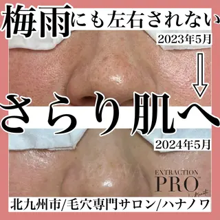 毛穴&リンパマッサー ジ専門サロン花のWAのエステ・リラクイメージ